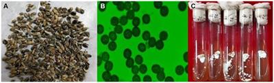 Draft genome sequencing of Tilletia caries inciting common bunt of wheat provides pathogenicity-related genes